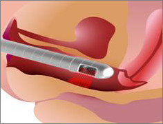 nietrzymanie moczu zielona góra chirurg urolog