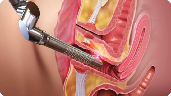 obkurczanie pochwy zielona góra chirurg urolog