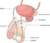 wazekotomia-zielona-gora wazekotomia zielona góa chirurg urolog